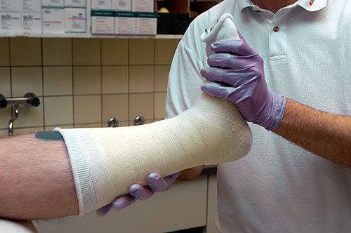 gipsfuss.jpg © gipsfuss.jpg ©